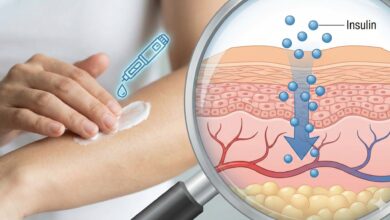 كريم الأنسولين الجديد
